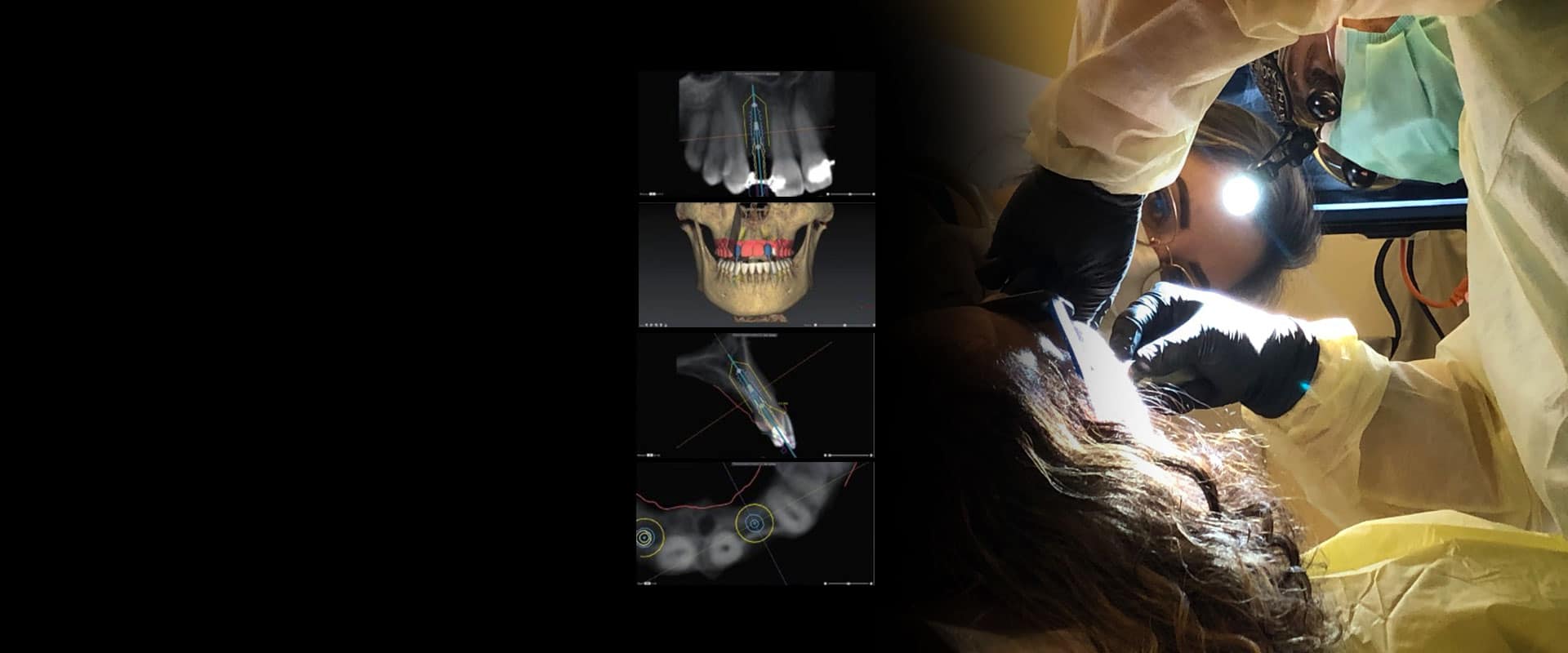 dental-implants-home-slider9